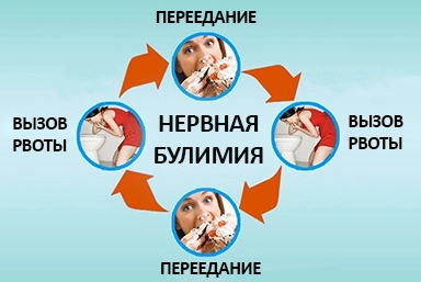 Лечение булимии в Чистополе